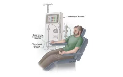 ¿Qué es la Hemodiálisis?